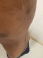 Escort Johnny Traditional massage